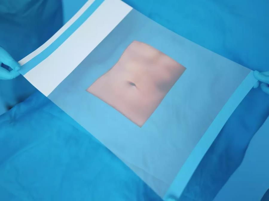 Surgeons apply incision drape on patient’s body