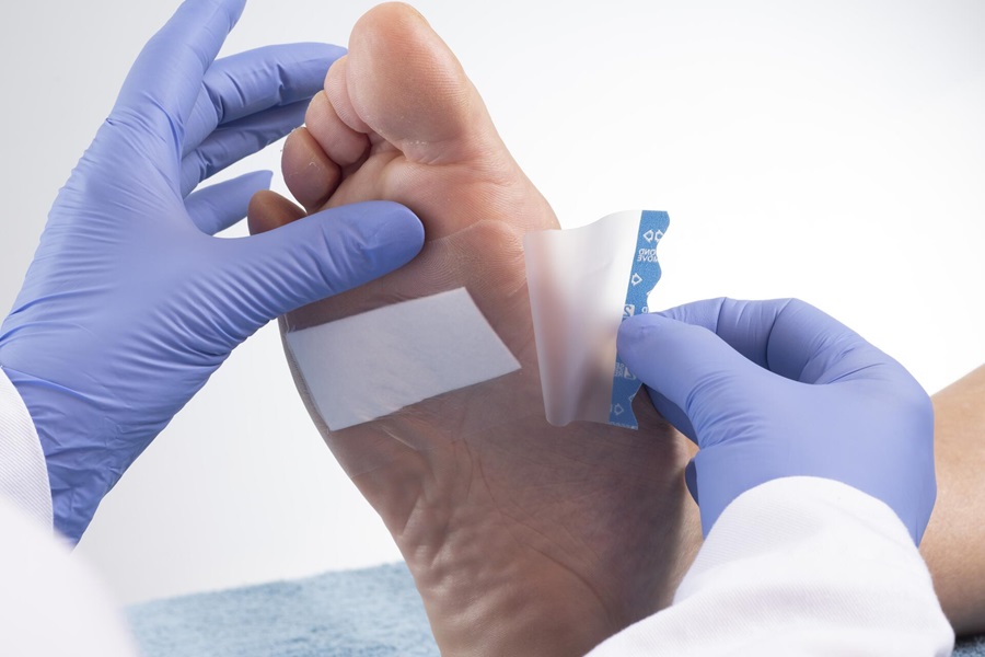 A thin wound dressing is placed on the sole of a foot.